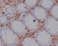 Anti-Vimentin Rabbit Monoclonal Antibody